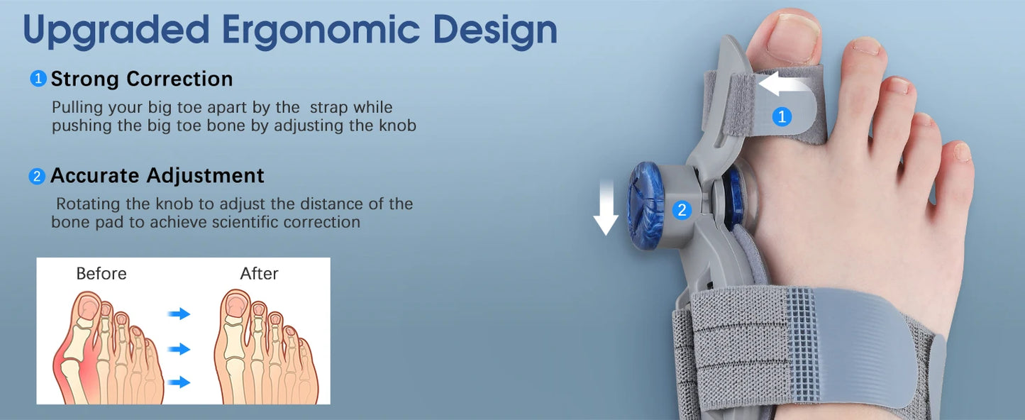 Big Bone Toe Bunion Splint Straightener